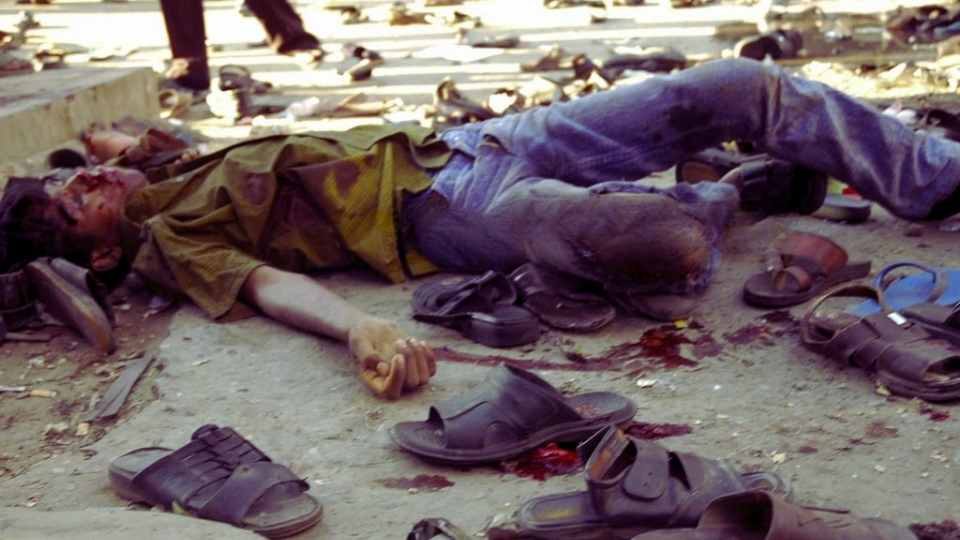 ২০০৪ সালের ২১ আগস্ট গ্রেনেড হামলায় ক্ষতবিক্ষত, রক্তাক্ত দেহের সেই ছবিগুলো আজও সেদিনের ভয়াবহতার সাক্ষ্য দেয়।